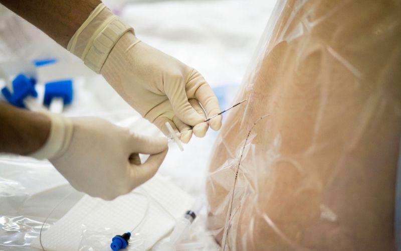 epiduralna, spinalna