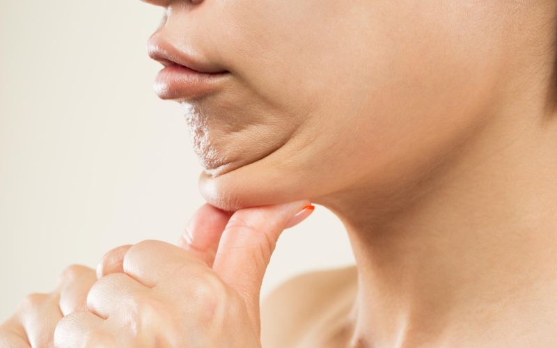 liposukcija vodilna shutterstock.jpg
