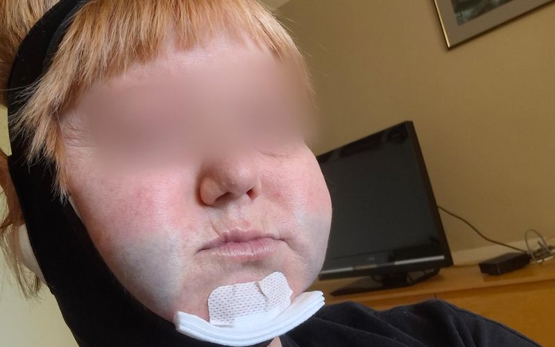 liposukcija2a.jpg