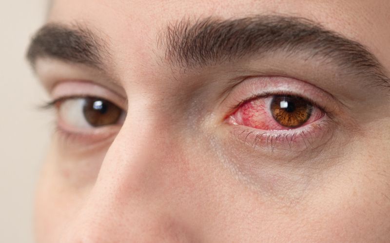 adenovirus.jpg
