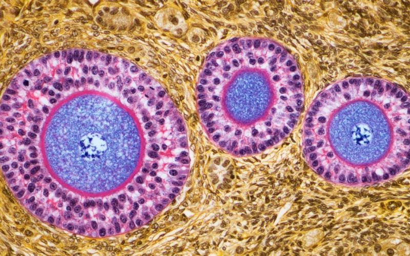 OvarianFollicles.jpg