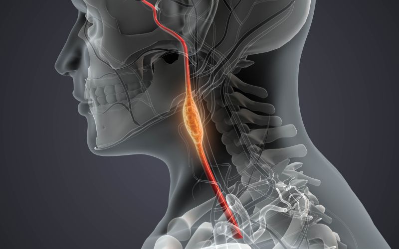tumor4.jpg