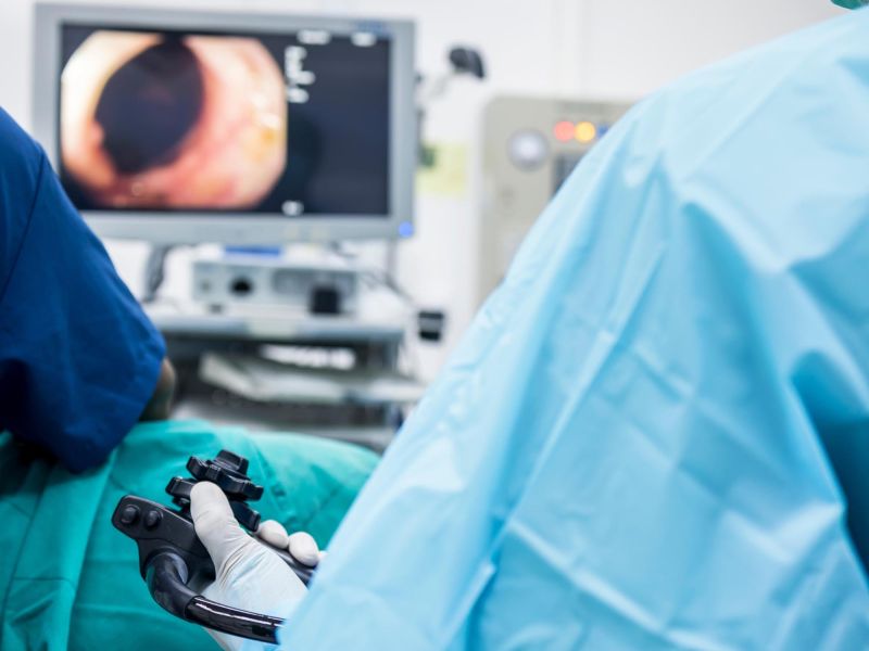 Napaka pri pripravi na kolonoskopijo lahko pomeni ponovitev pregleda