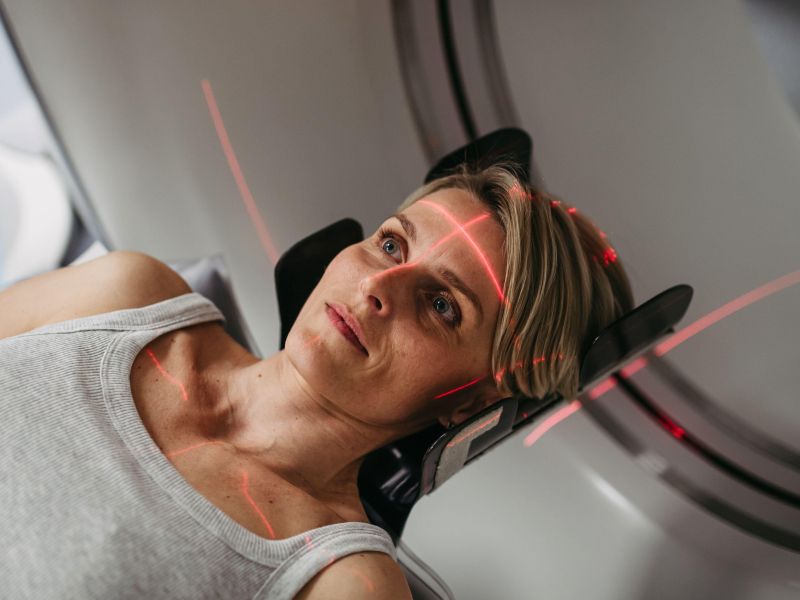 To jejte po rentgenskem slikanju: živila, ki pomagajo pri regeneraciji