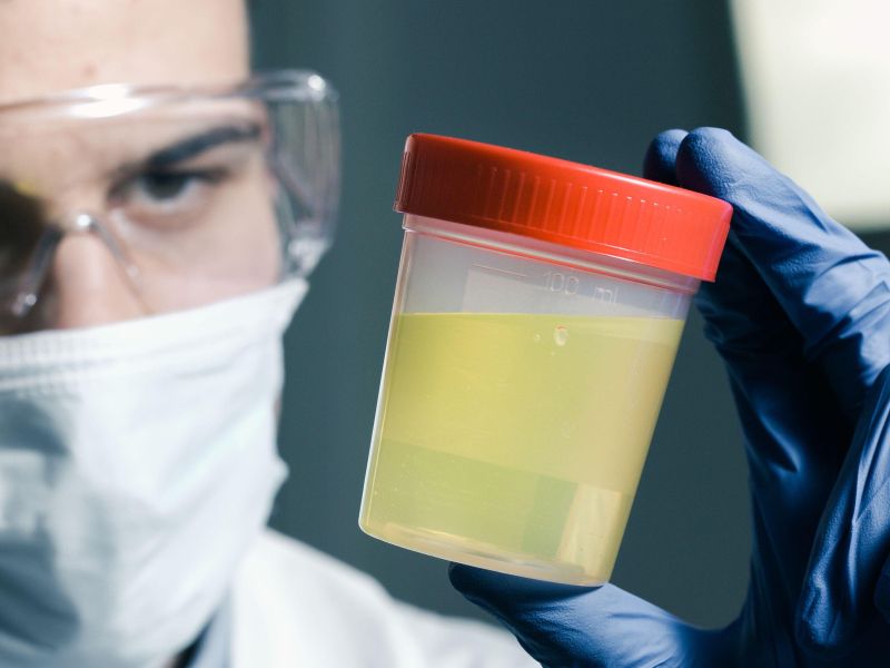 Tihi znak, ki lahko razkrije težave z ledvicami