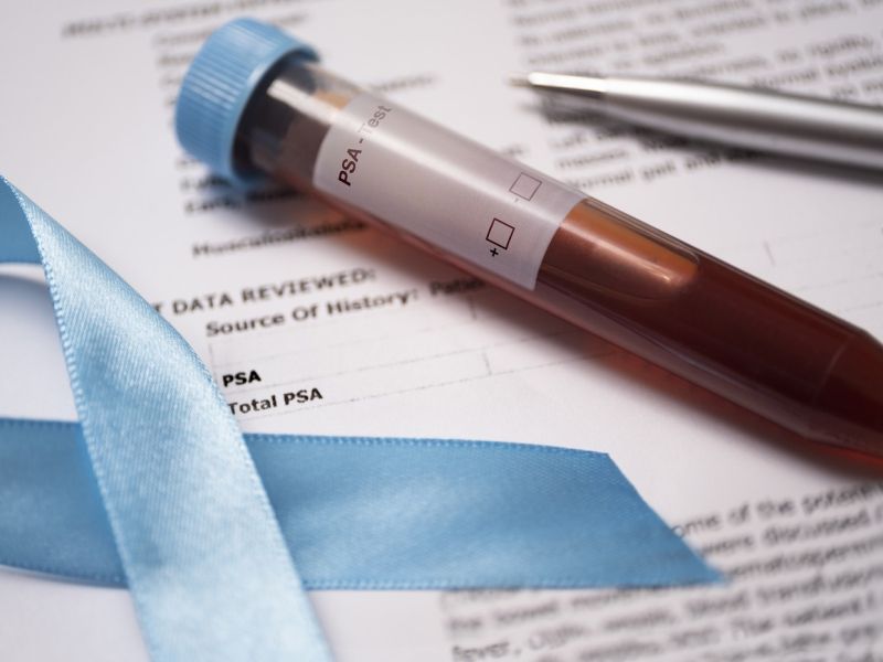 Slovenija uvaja program za raka prostate, ki lahko reši življenje moških