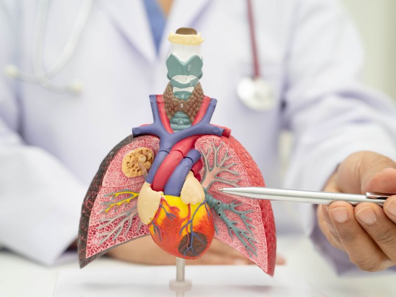 Preprost test lahko hitro razkrije zgodnje znake pljučnega raka
