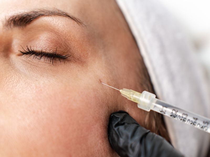 "Največja nevarnost nestrokovnega vbrizgavanja botoksa je lahko tudi smrt"
