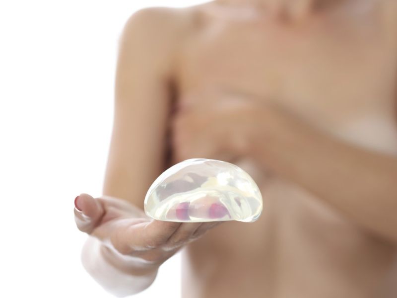 Lepota, ki boli: "Na to nisem bila pripravljena"