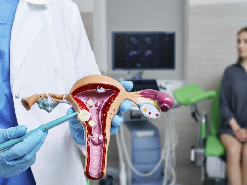 Krvavitve, bolečine, težave z zanositvijo: So krivi polipi?