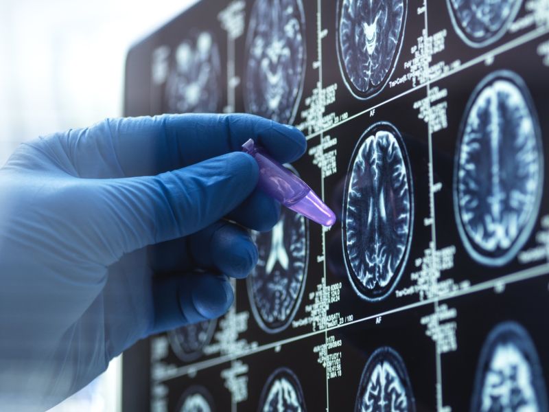 Zdravje teh 9 organov razkriva, katere bolezni vam grozijo