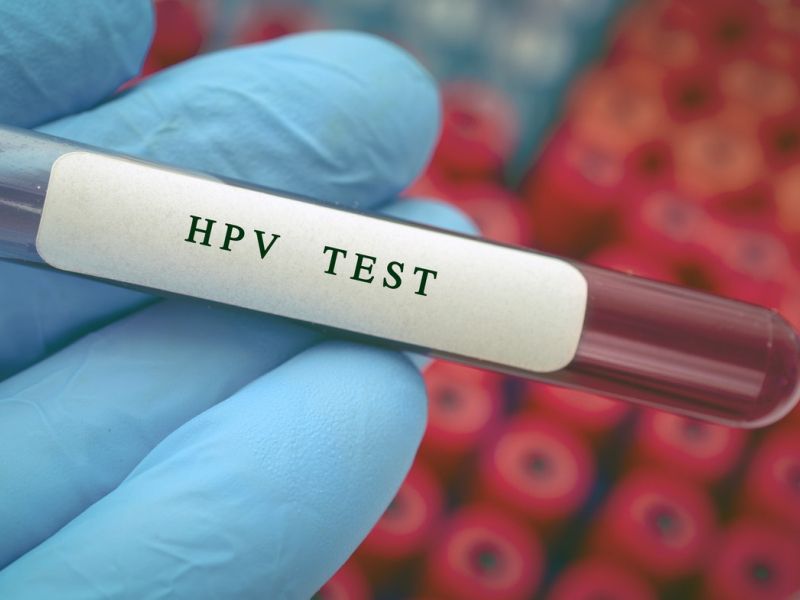 HPV: virus, s katerim se v življenju sreča kar 80 odstotkov ljudi