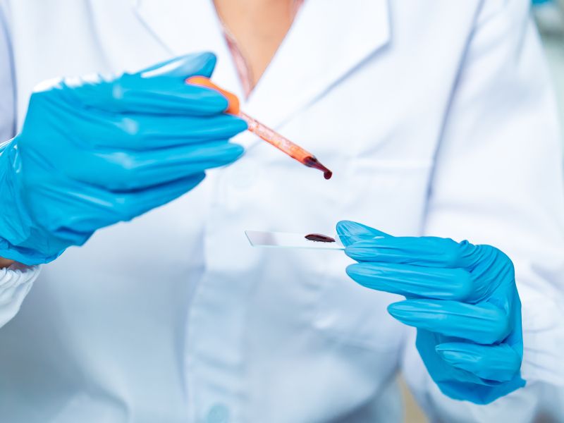 10 znakov v krvi, ki razkrivajo, da se starate prehitro