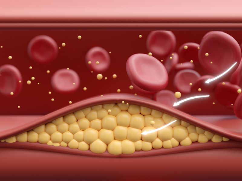 Tihi ubijalec udari nenadoma, teh 7 znakov je opozorilo