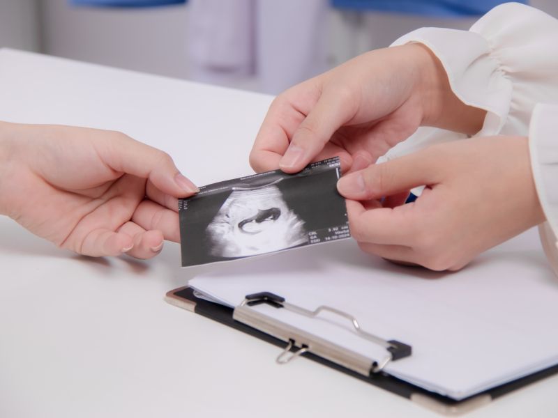 Pregledi v nosečnosti: Kaj vas čaka v prvem trimesečju?