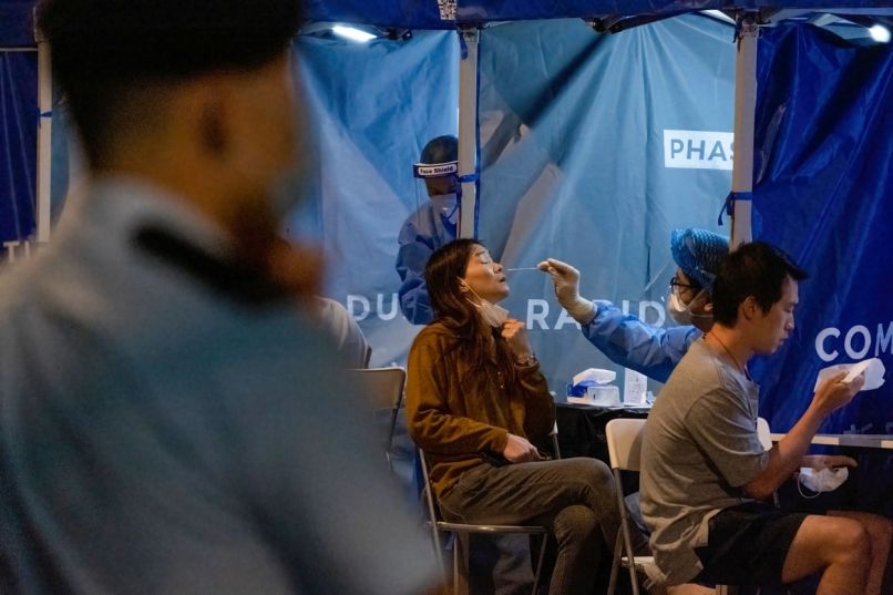 Japoncem ni všeč palčko potiskajo v anus