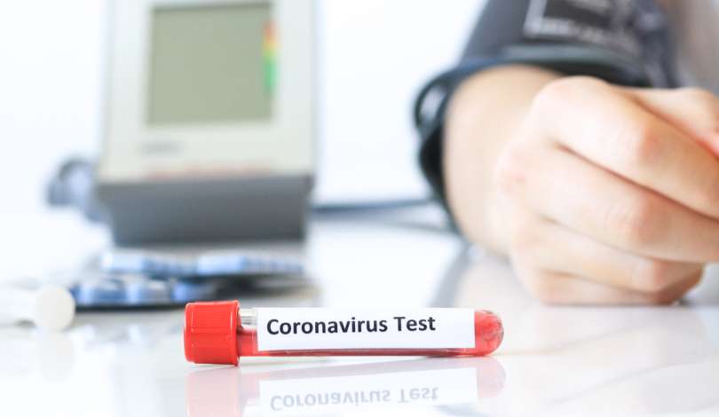 koronavirus, zdravstvo, epidemija