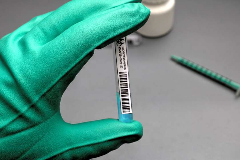 AVDIO: Krka ob enih – V novomeški bolnišnici tudi samoplačniško testiranje protiteles na covid-19